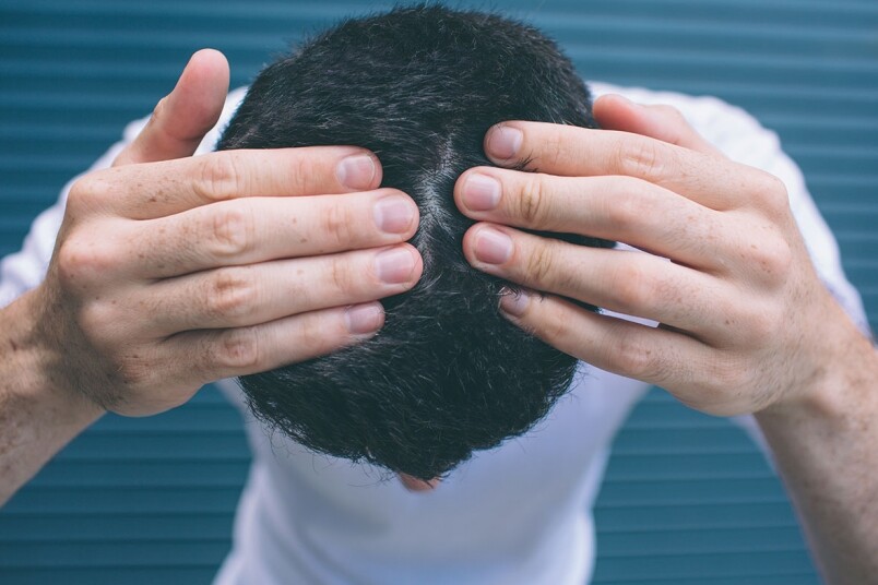 男士脫髮怎麼辦？Nanogen純天然角蛋白纖維髮粉，令頭髮瞬間增量