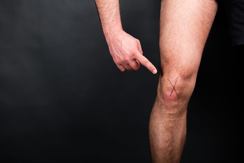 運動時膝頭啪一聲？運動時十字韌帶斷裂怎麼辦？應該選擇ACL重建手術或是保守治療？前十字韌帶撕裂/斷裂3大症狀