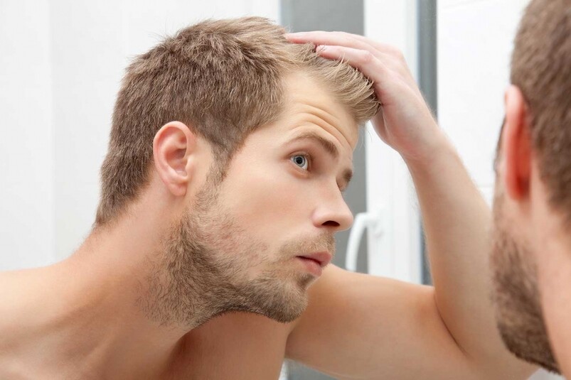 想了解自己有否脫髮，就要經常都檢查頭髮情況，最簡單的，就是洗頭後濕